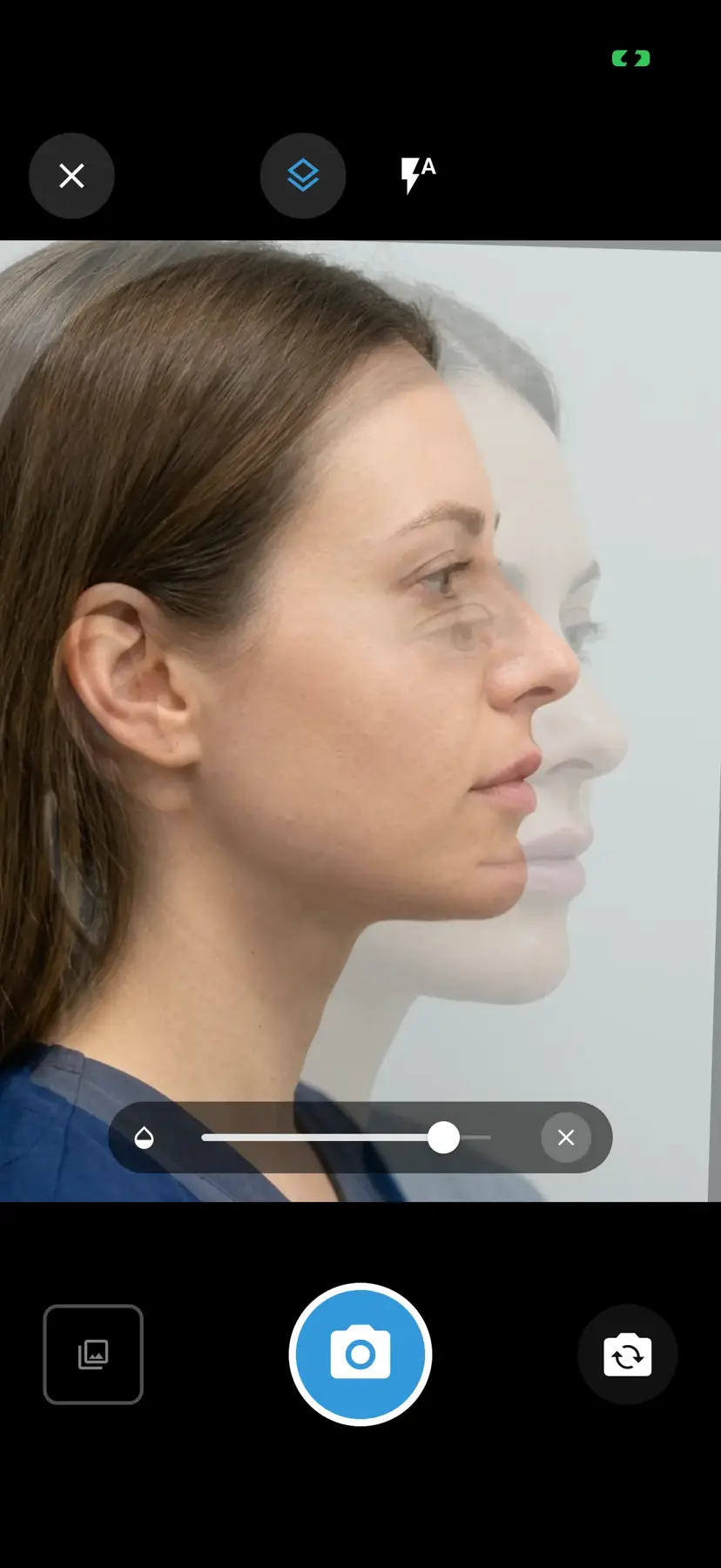 PixioDoc camera with ghost overlay showing a previous patient photo as a semi-transparent alignment guide