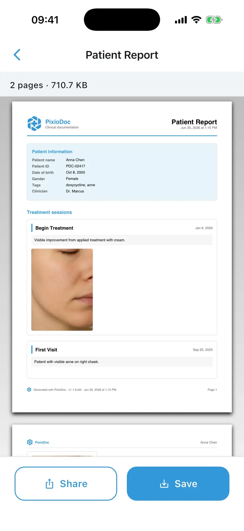 PixioDoc patient report screen showing PDF generation with selectable sessions and images